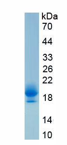 Active Interleukin 2 (IL2)