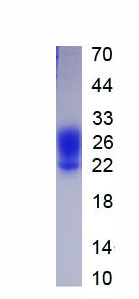 Active Interleukin 3 (IL3)