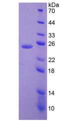 Active Interleukin 6 (IL6)