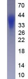 Active Interleukin 6 (IL6)