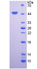 Active Interleukin 6 (IL6)