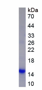 Active Monocyte Chemotactic Protein 1 (MCP1)