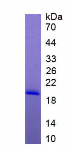 Active Monocyte Chemotactic Protein 1 (MCP1)