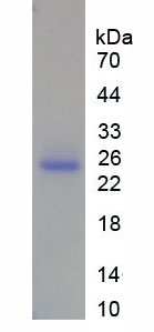 Active Matrix Metalloproteinase 13 (MMP13)