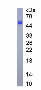 Active Matrix Metalloproteinase 3 (MMP3)