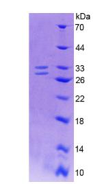 Active Nerve Growth Factor (NGF)