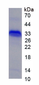 Active Nerve Growth Factor (NGF)