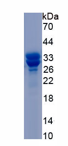 Active Superoxide Dismutase 3, Extracellular (SOD3)