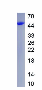 Active Superoxide Dismutase 3, Extracellular (SOD3)