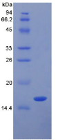 Active Transforming Growth Factor Beta 1 (<b>TGFb1</b>)