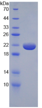 Active Tumor Necrosis Factor Alpha (TNFa)