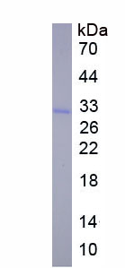 Active Tumor Necrosis Factor Related Apoptosis Inducing Ligand (TRAIL)