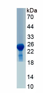 Active Plasminogen Activator, Urokinase Receptor (uPAR)