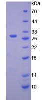 Active Hexosaminidase A Alpha (HEXa)