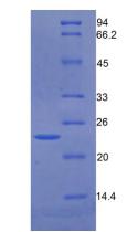 Active Growth Arrest Specific Protein 6 (GAS6)