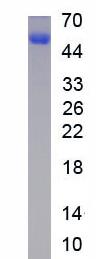 Active Alpha-1-Microglobulin (a1M)