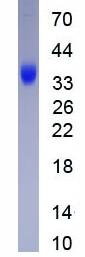 Active Alpha-1-Microglobulin (a1M)