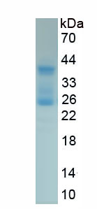 Active Interferon Beta (IFNb)