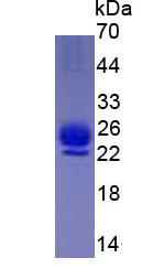 Active Interleukin 1 Receptor Antagonist (IL1RA)