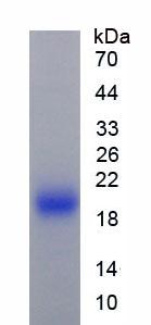 Active Interleukin 1 Receptor Antagonist (IL1RA)