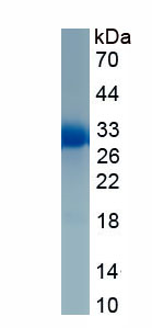 Active Protease, Serine 1 (PRSS1)