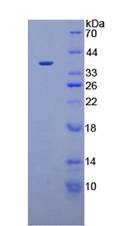 Active Annexin V (ANXA5)