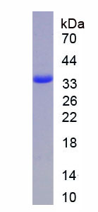 Active Annexin V (ANXA5)