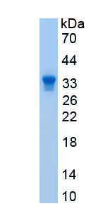 Active Heparin Cofactor II (HCII)