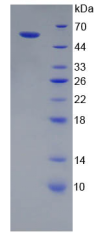 Active Cathepsin A (CTSA)