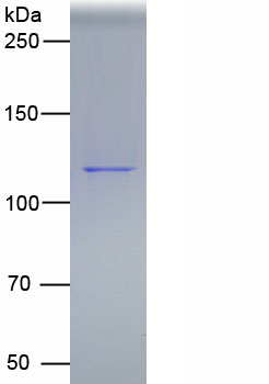 Active Platelet/Endothelial Cell Adhesion Molecule (PECAM1)