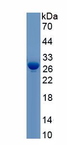 Active Gelsolin (GSN)