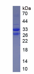 Active Desmin (Des)