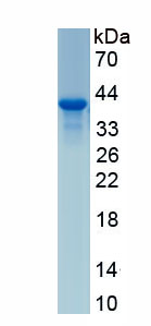 Active Complement Component 3a (C3a)