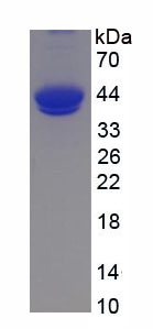 Active Complement Component 5a (C5a)