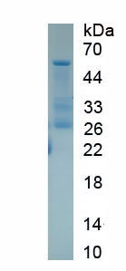 Active Mineralocorticoid Receptor (MR)