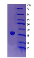 Active Endothelin 1 (EDN1)