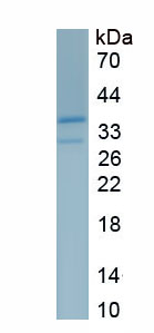 Active Immunoglobulin E (IgE)