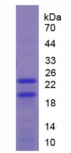 Active Fibroblast Growth Factor 2, Basic (FGF2)