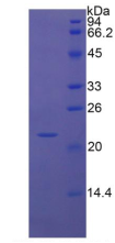 Active Interleukin 1 Beta (IL1b)