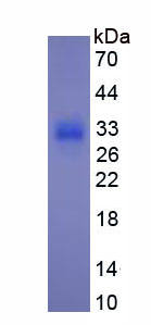 Active Procollagen III N-Terminal Propeptide (PIIINP)