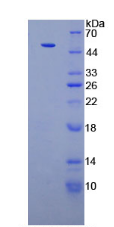 Active Pyruvate kinase isozymes M2 (PKM2)