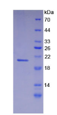 Active Fibrillin 1 (FBN1)