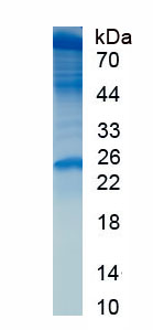 Active Myeloperoxidase (MPO)