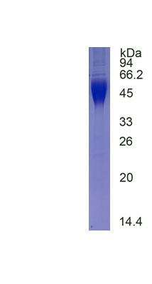 Active Cluster Of Differentiation 28 (CD28)