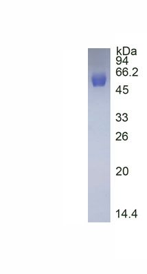 Active Cluster Of Differentiation 14 (CD14)