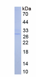 Active Heat Shock Protein 27 (Hsp27)