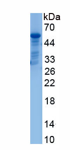Active Dickkopf Related Protein 1 (DKK1)