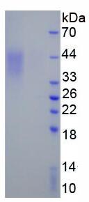 Active Programmed Cell Death Protein 1 (PD1)