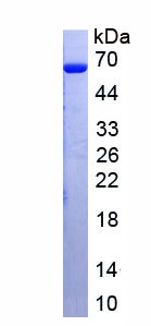 Active Lactoferrin (LTF)