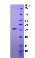 Active Cluster Of Differentiation 276 (CD276)